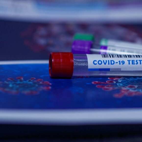 Diagnóstico da COVID-19 utilizando antígeno peptídico sintético proveniente da proteína do nucleocapsídeo